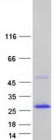 Human SSPN / Sarcospan Protein (Recombinant Myc-DDK (Flag))