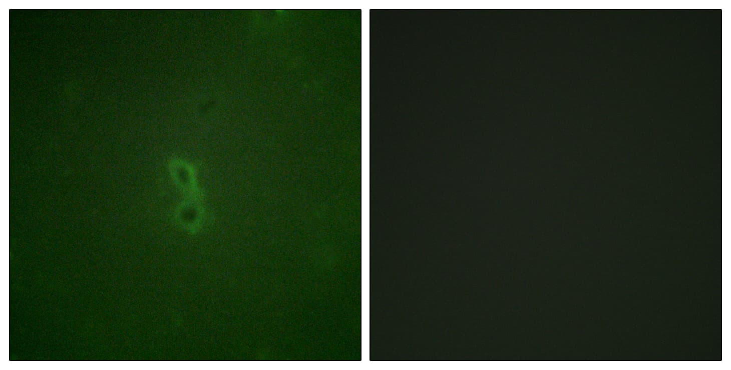 Polyclonal Rabbit anti-Human BCL2L1 / BCL-XL Antibody (phospho-Thr47, IHC, IF, WB)