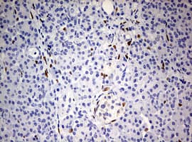 ZEB1 / AREB6 Antibody (aa1-350, clone OTI7E12)