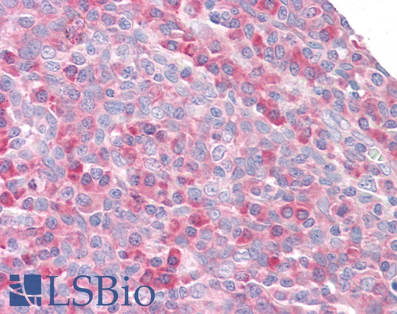 IHC-plus™ RPS27 / Ribosomal Protein S27 Antibody (aa2-14)