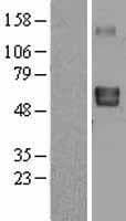 Human LTBR Protein (Over-Expression Lysate Myc-DDK (Flag))