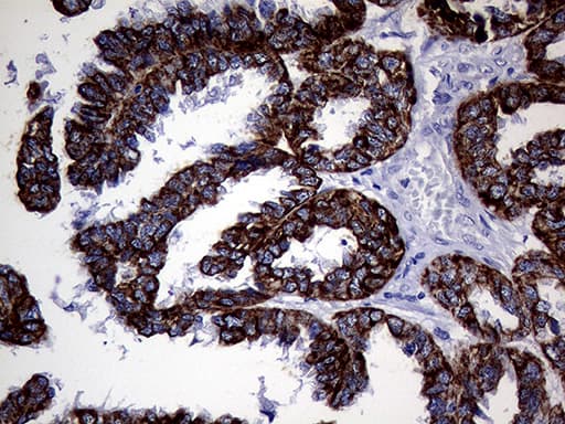 KRT8 / CK8 / Cytokeratin 8 Antibody (aa91-381, clone OTI2F5)