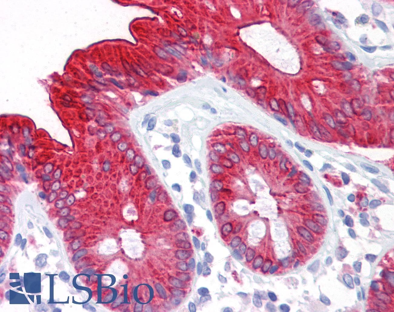PathPlus™ Monoclonal Mouse anti-Human CEA / Carcinoembryonic Antigen Antibody (clone PARLAM 4, IHC, WB)