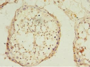 USP45 Antibody