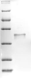 Mouse KLK14 / Kallikrein 14 Protein (Recombinant 6His, N-terminus)
