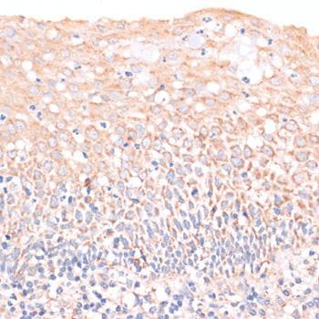 EIF4EBP1 / 4EBP1 Antibody