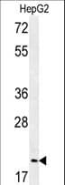 Polyclonal Rabbit anti-Human Geminin Antibody (aa96-123, IHC, WB)