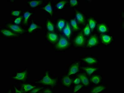 CRYBA1 Antibody