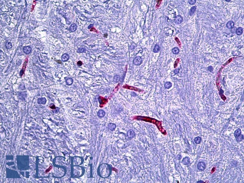 IHC-plus™ RECA-1 Antibody (clone HIS52)