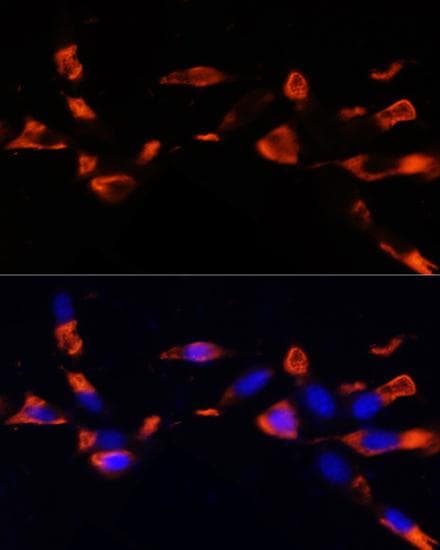 MCTS1 Antibody