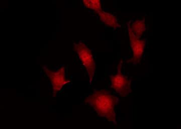 FER Antibody