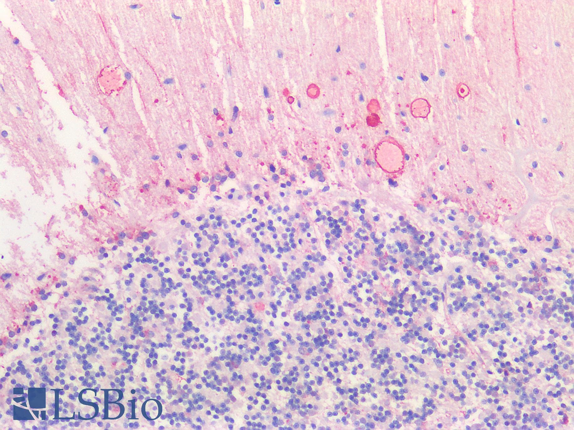 IHC-plus™ Polyclonal Rabbit anti-Human HTR2C / 5-HT2C Receptor Antibody (C-Terminus, IHC)
