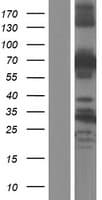 ABLIM2 Protein (Over-Expression Lysate Myc-DDK (Flag))
