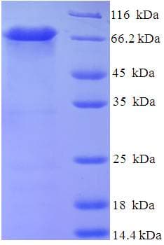 Human CPVL Protein (Recombinant His-SUMO)