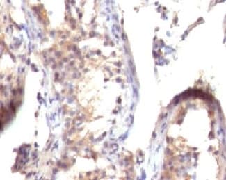 TGFA / TGF Alpha Antibody (clone TFGFa-1)