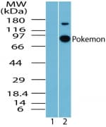 IHC-plus™ ZBTB7A / Pokemon Antibody
