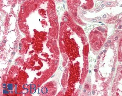 CTH / Cystathionase Antibody (clone OTI1E12, Carrier-free)