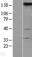 NGN / Neogenin Protein (Over-Expression Lysate Myc-DDK (Flag))