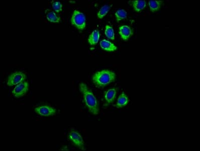 Polyclonal Rabbit anti-Human GPR32 Antibody (IHC, IF, WB)