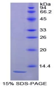 Horse IL8 / Interleukin 8 Protein (Recombinant His)