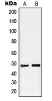 Polyclonal Rabbit anti-Human GPR19 Antibody (C-Terminus, WB)