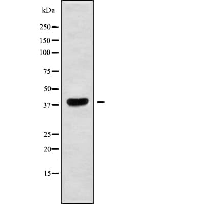 MAGE10 / MAGEA10 Antibody