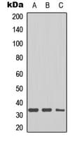 DHRS4 / PSCD Antibody (C-Terminus)