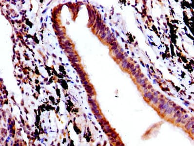 FCGRT / FCRN Antibody