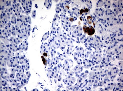 FTCD / 58K Golgi Protein Antibody (clone UMAB123, Carrier-free)
