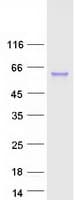 Human CTSC / Cathepsin C / JP Protein (Recombinant Myc-DDK (Flag))