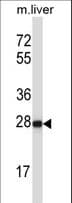 HELT Antibody (aa131-160)