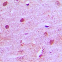 MNAT1 Antibody (Internal)