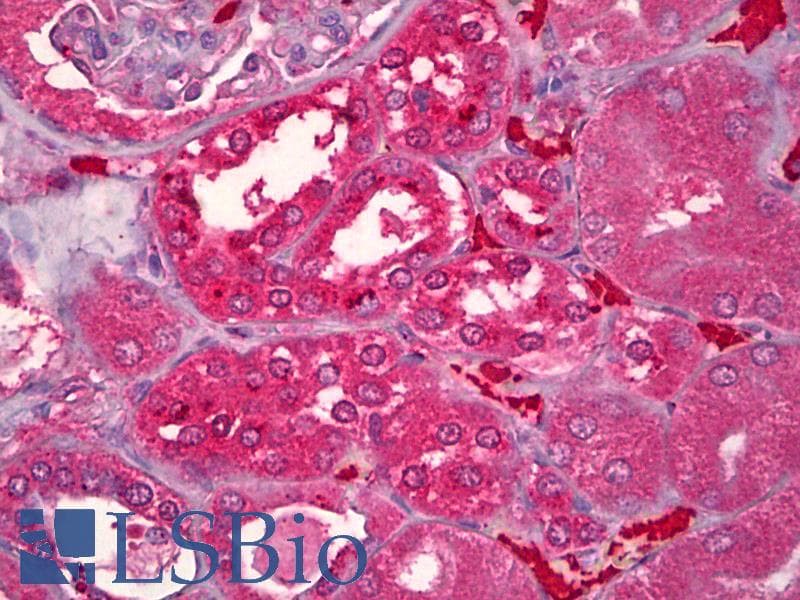 IHC-plus™ AGT / Angiotensinogen Antibody (Internal, clone EPR2930(2))