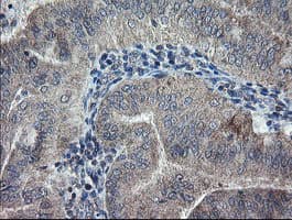 CHN1 Antibody (clone OTI2D10, Carrier-free)