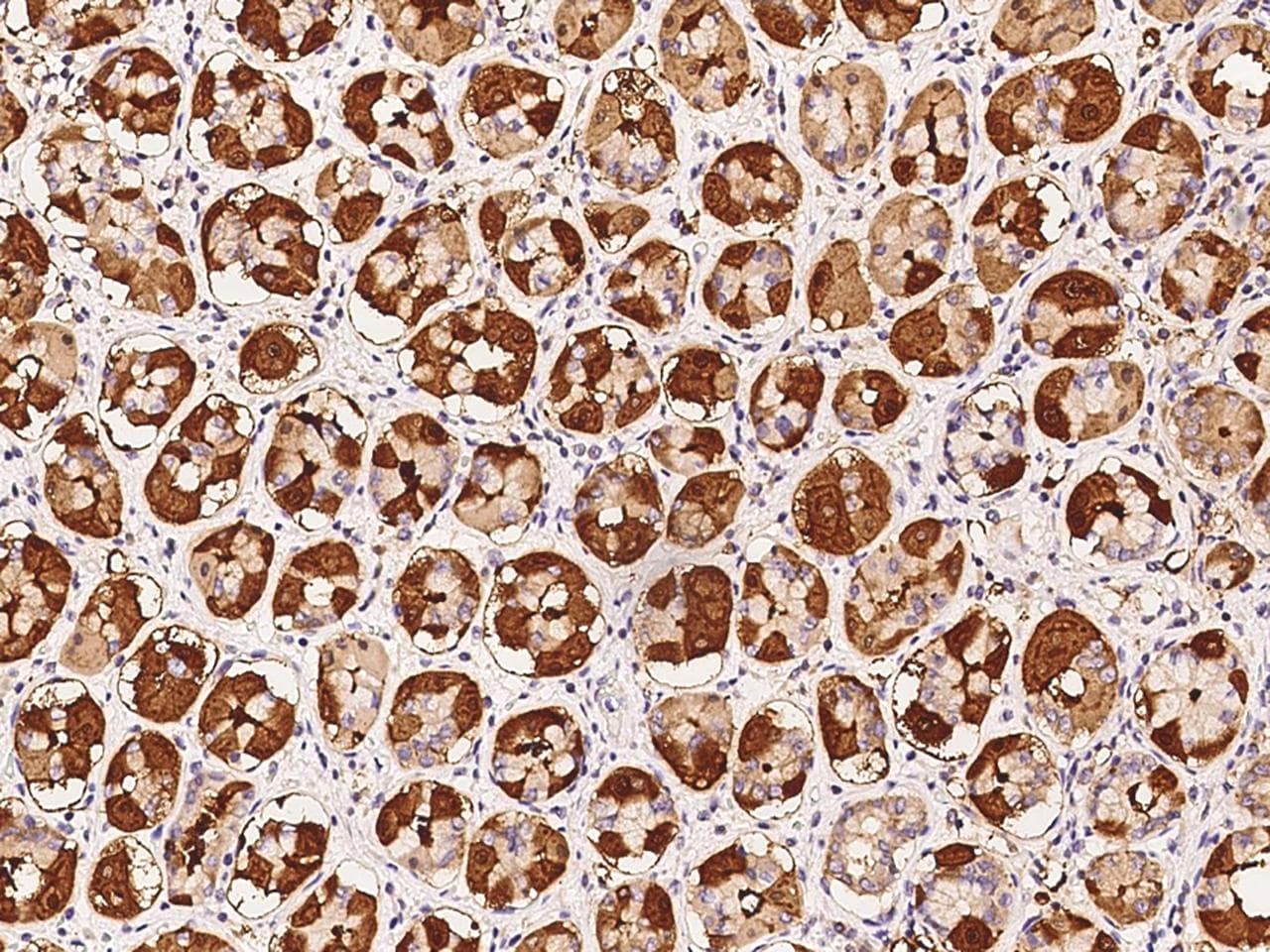 OXA1L / OXA1 Antibody