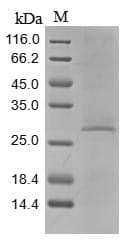 Mouse C1QTNF3 / CTRP3 Protein (Recombinant 10His, N-terminus)