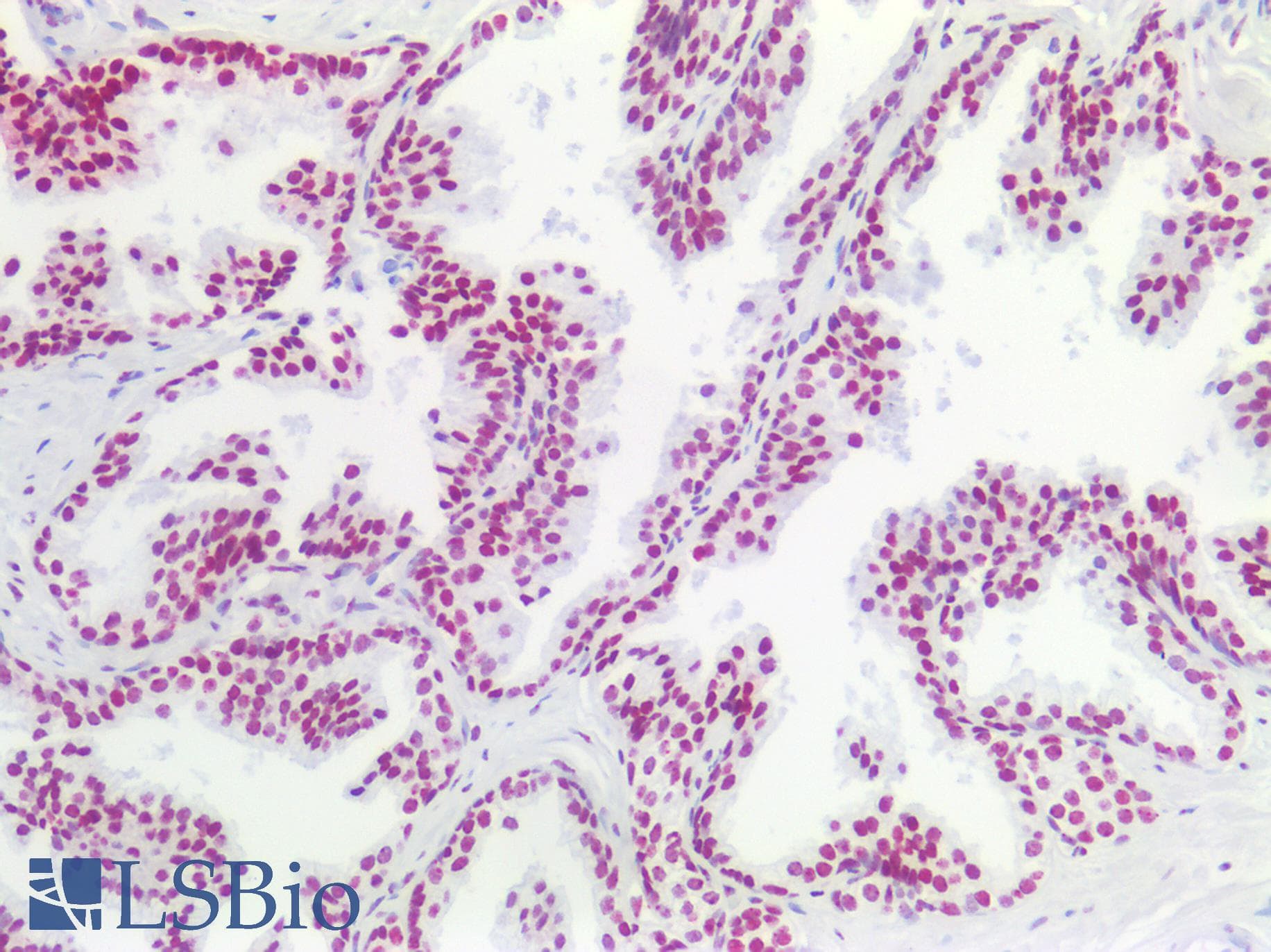PathPlus™ SMN1 Antibody (aa50-100)