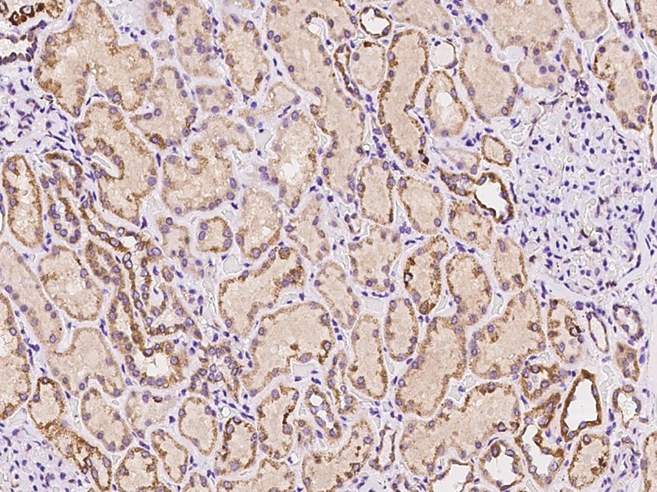 Polyclonal Rabbit anti-Human TRAF3IP1 Antibody (IHC)