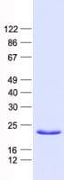 Human BIK Protein (Recombinant His, N-Terminal)