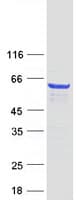 Human MPP2 Protein (Recombinant Myc-DDK (Flag))