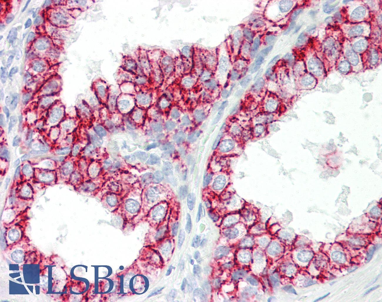 PathPlus™ CLDN4 / Claudin 4 Antibody (aa160-209)