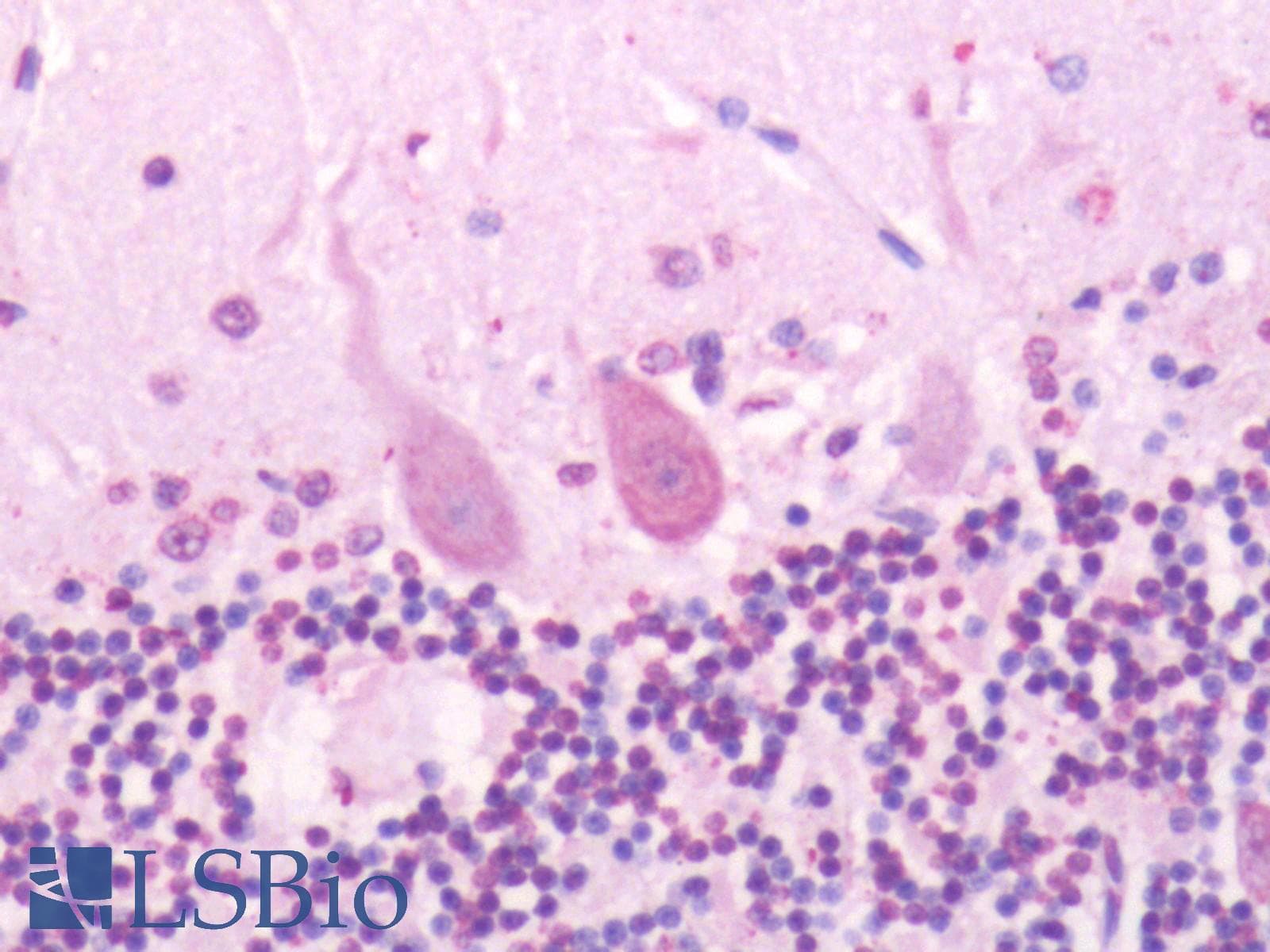 IHC-plus™ SSTR2 Antibody (Extracellular Domain)
