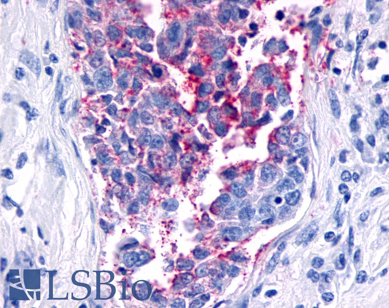 PathPlus™ FZD8 / Frizzled 8 Antibody (N-Terminus)