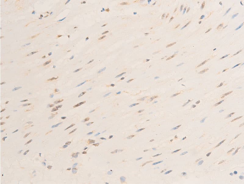 RELA / NFKB p65 Antibody (phospho-Ser536)