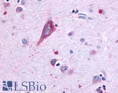 PathPlus™ FFAR2 / GPR43 Antibody (Extracellular Domain)