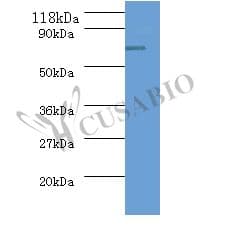 ureB / Urease Beta Antibody (Biotin)