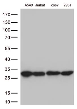 Monoclonal Mouse anti-Human BCL2 / Bcl-2 Antibody (clone OTI5H8, WB)