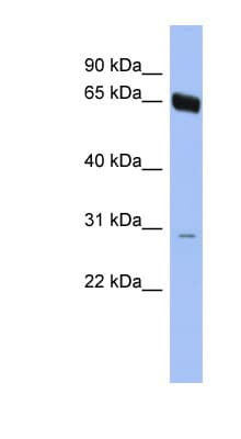 Polyclonal Rabbit anti-Human TAF5L Antibody (N-Terminus, WB)
