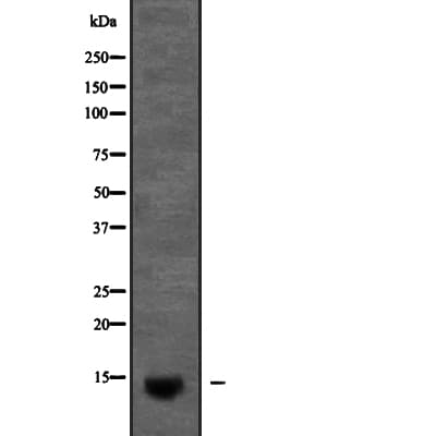 MIRP1 / KCNE2 Antibody