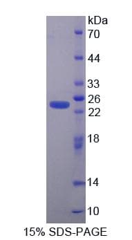 Human SERPINB4 / SCCA1+2 Protein (Recombinant His-T7)